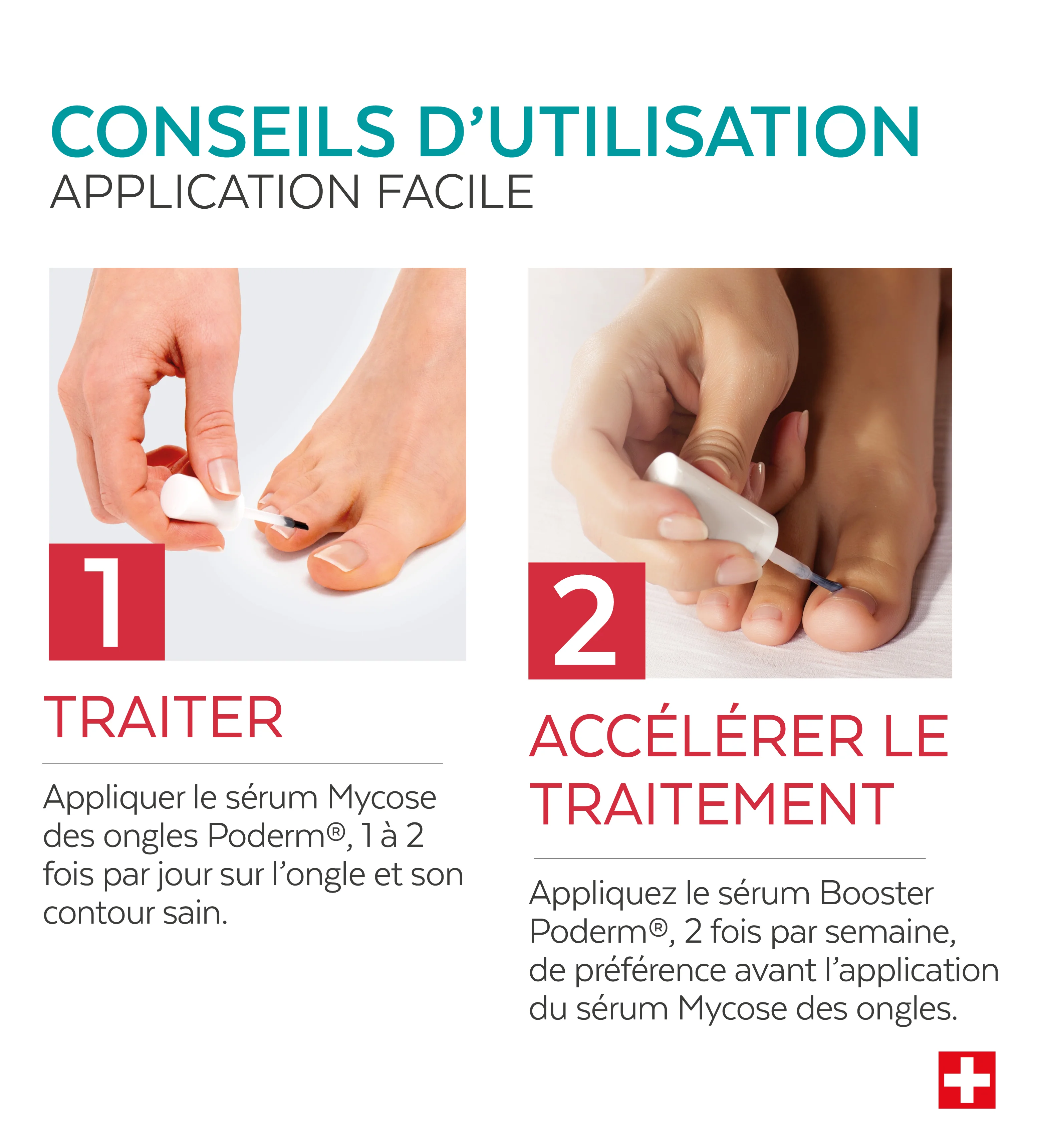 Duo express - Mycose des ongles - Image 5