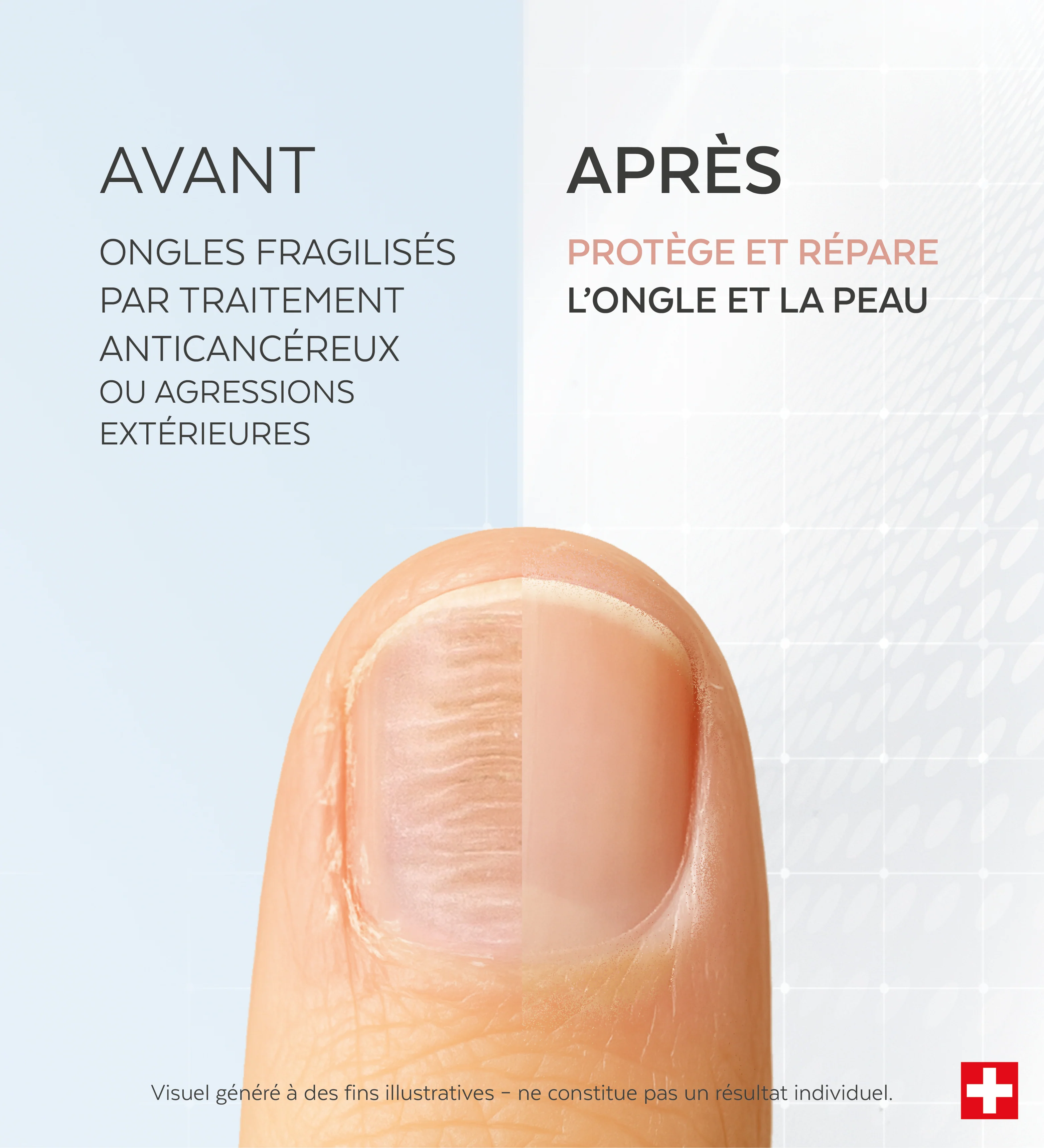 Sérum Ongles fragilisés Silicium - Image 3