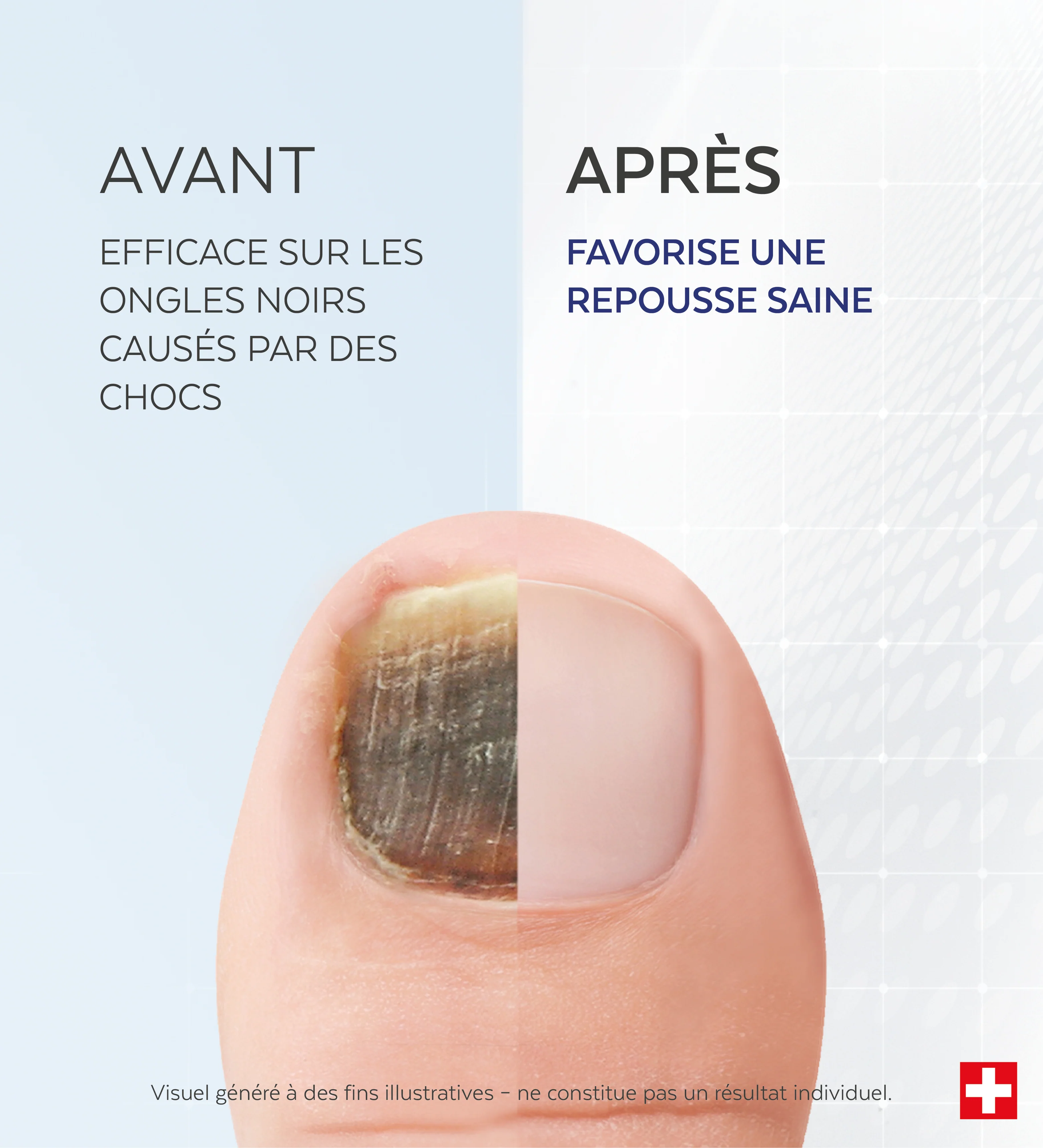 Sérum Ongles noirs, traumatisés - Image 4