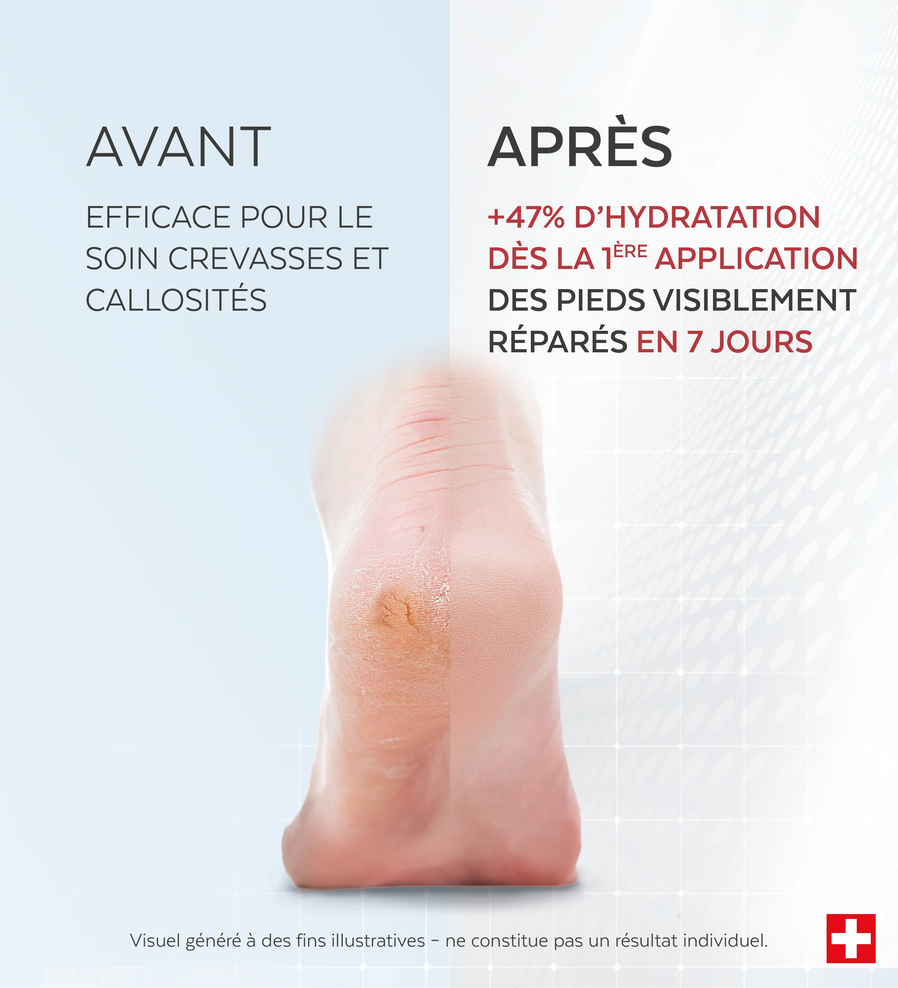 Soin Crevasses et Callosités - Image 3