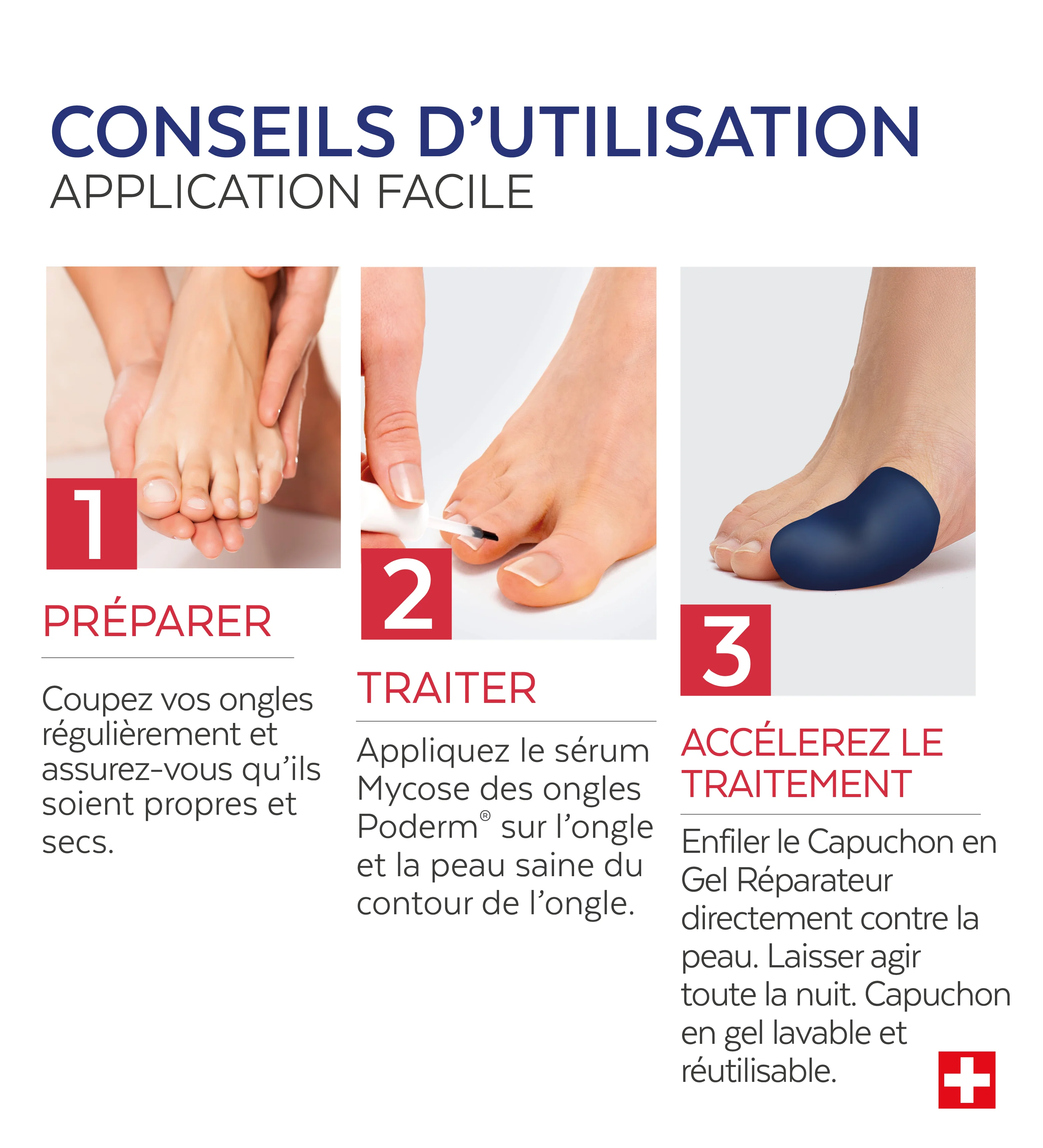Traitement Intensif Nuit - Mycose des ongles - Image 4