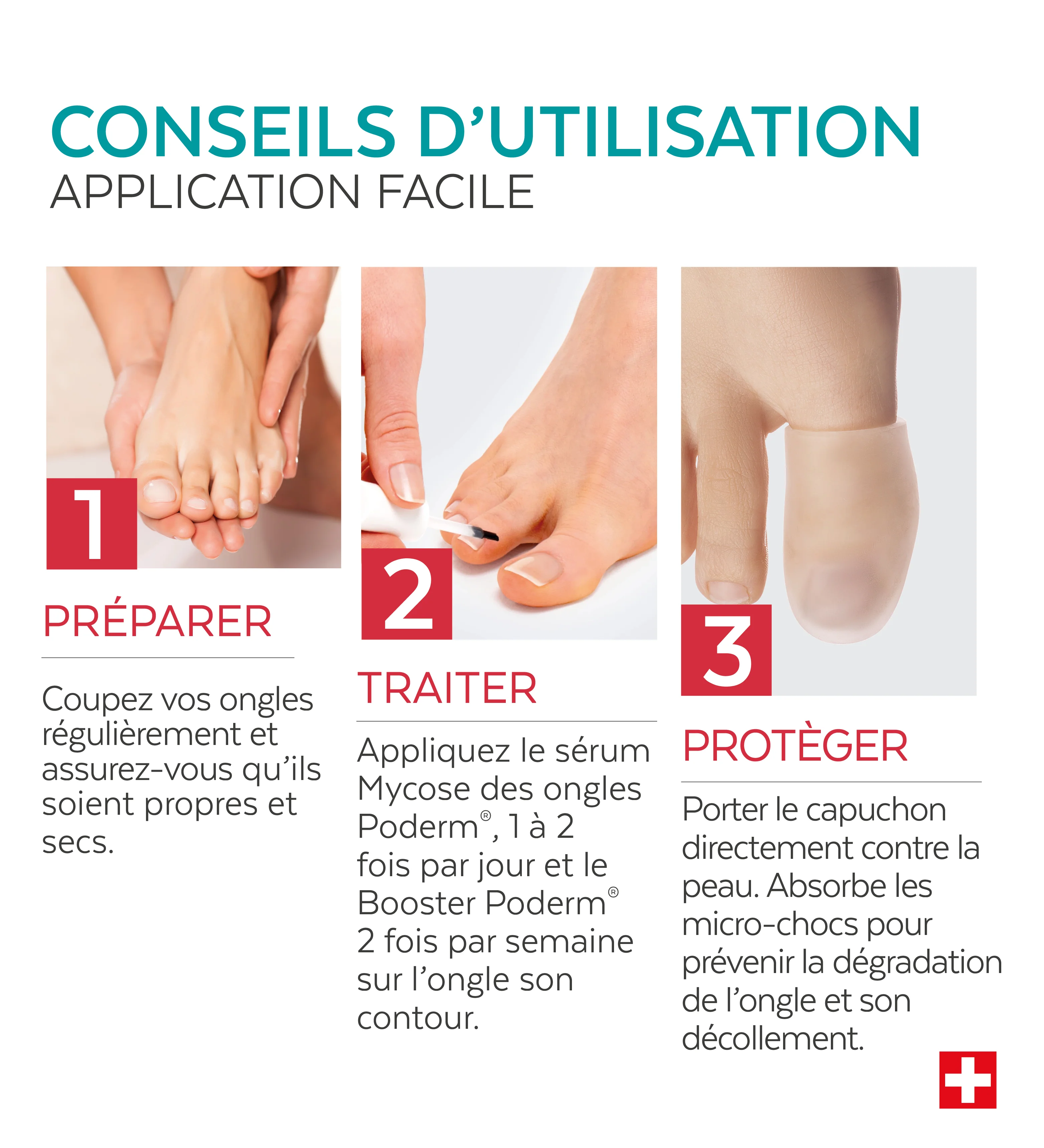 Trio Capuchon - Mycose des ongles - Image 4